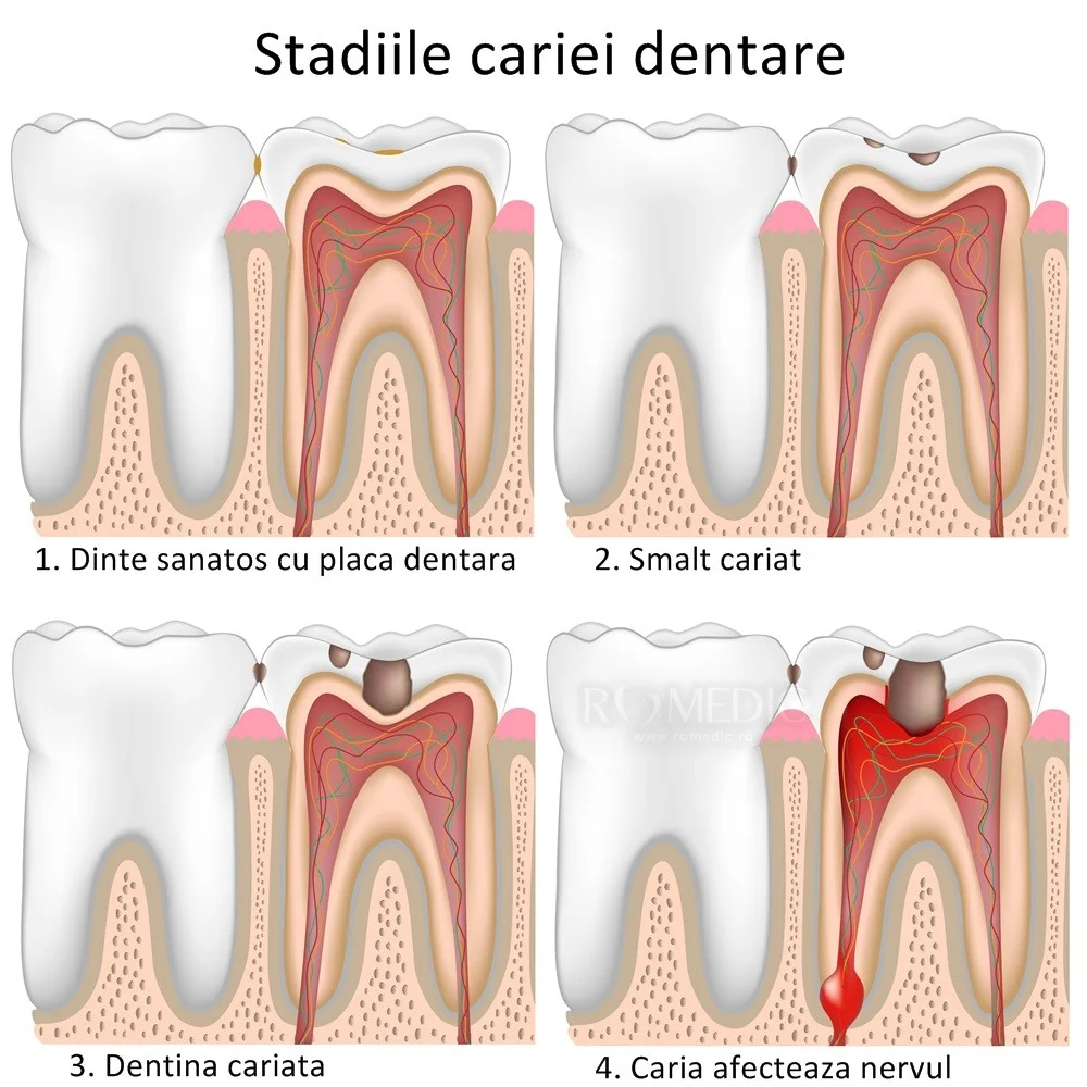 Toothache: causes and treatment