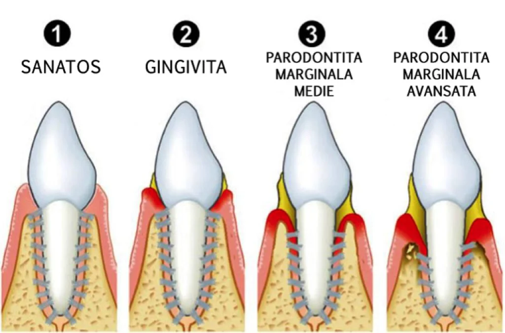 Professional cleaning and dental health