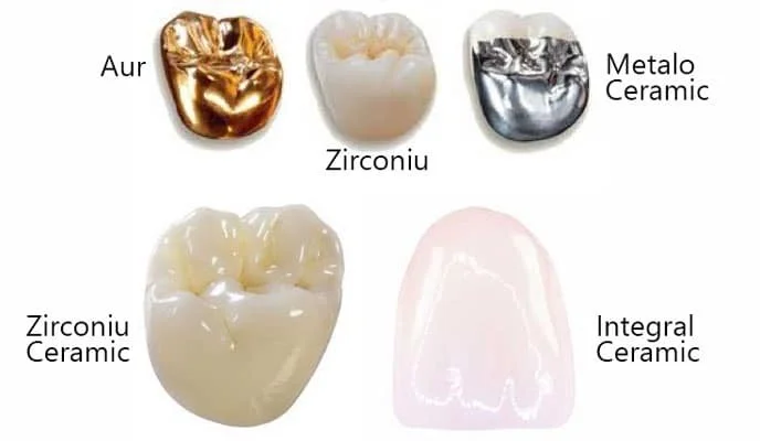 Dental crowns: materials, stages and costs