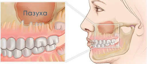 Toothache: causes and treatment