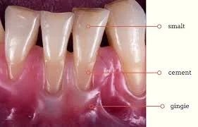 Toothache: causes and treatment